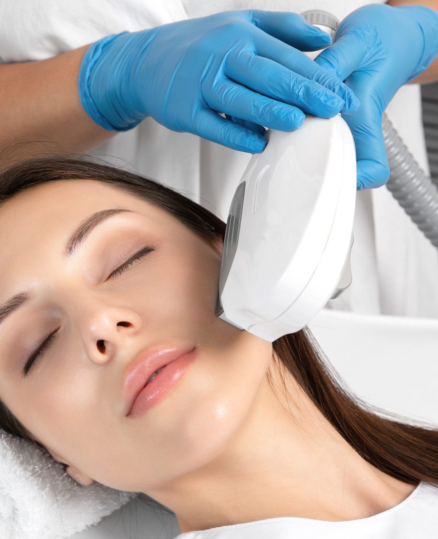 IPL Treatment 